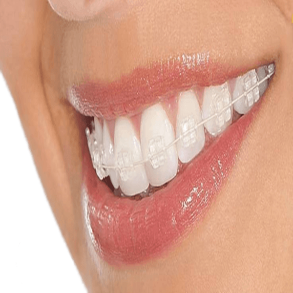 Best Cosmetic Dentist in Kolkata
