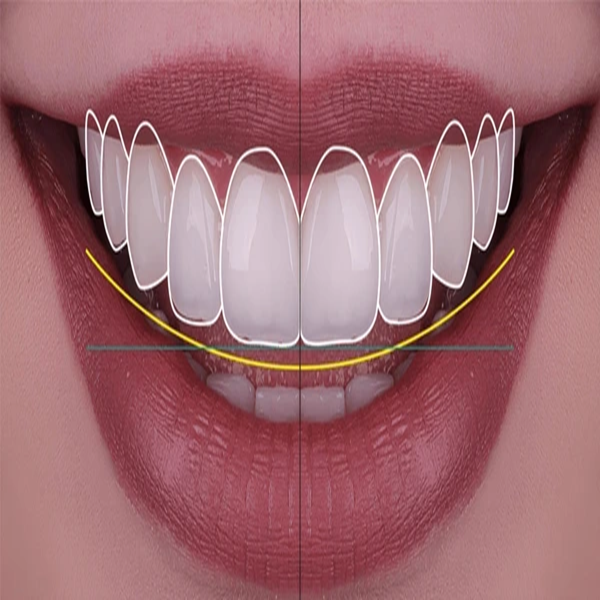 Best Cosmetic Dentist in Kolkata