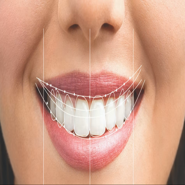 Best Cosmetic Dentist in Kolkata