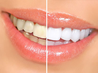 Best Cosmetic Dentist in Kolkata